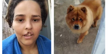 ‘Tive que recomeçar’, relata tutora que teve parte do lábio arrancado por cachorro em RO