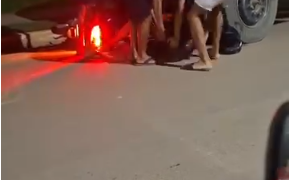 MACHADINHO: Jovem perde o controle de motocicleta ao tentar empinar e sofre grave acidente na madrugada