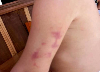 Criança de 9 anos é encontrada sozinha em casa e com hematomas