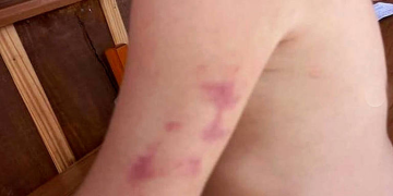 Criança de 9 anos é encontrada sozinha em casa e com hematomas