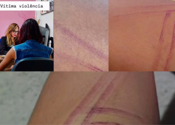 Mulher relata agressões com fios elétricos e ameaças de morte em Machadinho d’Oeste